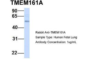 Host:  Rabbit  Target Name:  TMEM161A  Sample Type:  Human Fetal Lung  Antibody Dilution:  1. (TMEM161A Antikörper  (Middle Region))