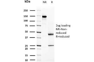SDS-PAGE Analysis Purified Prolactin Mouse Monoclonal Antibody (PRL/2644). (Prolactin Antikörper  (AA 63-201))