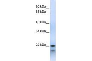 Image no. 1 for anti-Polymerase (RNA) III (DNA Directed) Polypeptide H (22.9kD) (POLR3H) (C-Term) antibody (ABIN6743479)