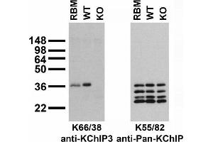 Immunoblot versus crude membranes from adult rat brain (RBM) and WT and KChIP3 KO mouse brains probed with K66/38 (left) and K55/82 (right) TC supe.