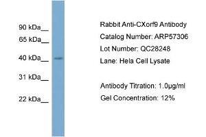 WB Suggested Anti-CXorf9  Antibody Titration: 0. (SASH3 Antikörper  (C-Term))