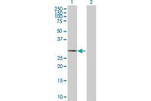 Western Blot analysis of CA3 expression in transfected 293T cell line by CA3 MaxPab polyclonal antibody. (CA3 Antikörper  (AA 1-260))