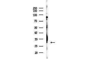 anti-Chloride Intracellular Channel 4 (CLIC4) (N-Term) antibody