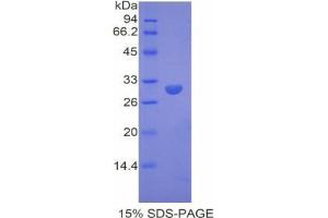 SDS-PAGE analysis of Mouse Dystrophin Protein.
