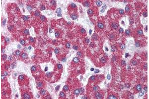 Human Liver (formalin-fixed, paraffin-embedded) stained with ATG7 antibody ABIN305895 at 5 ug/ml followed by biotinylated goat anti-rabbit IgG secondary antibody ABIN481713, alkaline phosphatase-streptavidin and chromogen. (ATG7 Antikörper  (C-Term))