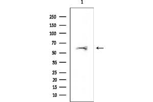 Western blot analysis of lysates from EC304 cells, using ATIC Mouse Monoclonal Antibody at 1/1000 dilution.