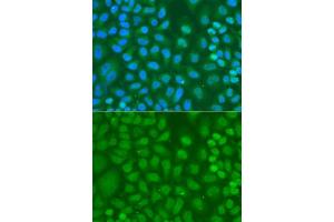 Immunofluorescence analysis of A-549 cells using CXXC1 antibody. (CXXC1 Antikörper  (AA 1-210))