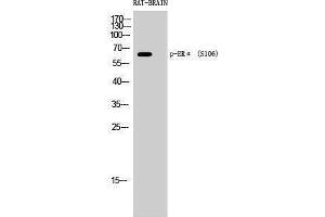 Western Blotting (WB) image for anti-Estrogen Receptor 1 (ESR1) (pSer106) antibody (ABIN3172892) (Estrogen Receptor alpha Antikörper  (pSer106))