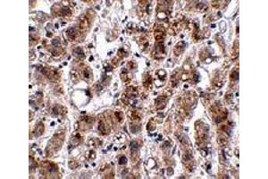 Immunohistochemistry of ACOT13 in human liver tissue with ACOT13 polyclonal antibody  at 2. (THEM2 Antikörper  (C-Term))