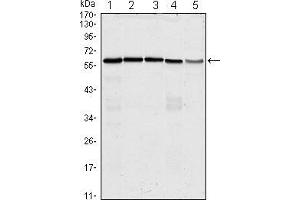 Western blot analysis using anti-CDC25C mAb against Hela (1), K562 (2), PC-3 (3), HEK293 (4) and Raw264. (CDC25C Antikörper)