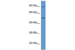 Western Blot showing CYP2W1 antibody used at a concentration of 1 ug/ml against Fetal Lung Lysate