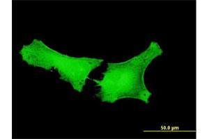 Immunofluorescence of purified MaxPab antibody to GPATCH2 on HeLa cell. (GPATCH2 Antikörper  (AA 1-376))