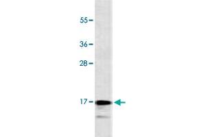 Western Blot analysis of CEM cell lysate (35 ug/lane) with CALCA monoclonal antibody, clone 406CT21. (CGRP Antikörper  (AA 56-84))