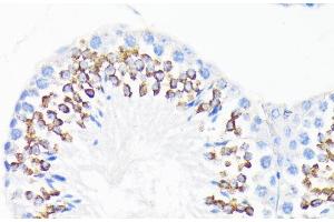 Immunohistochemistry of paraffin-embedded Mouse testis using CAMP Polyclonal Antibody at dilution of 1:200 (40x lens). (Cathelicidin Antikörper)