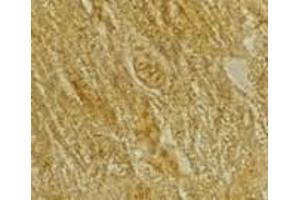 Immunohistochemistry of BACE2 in rat heart tissue with BACE2 antibody at 2 μg/ml. (BACE2 Antikörper  (C-Term))