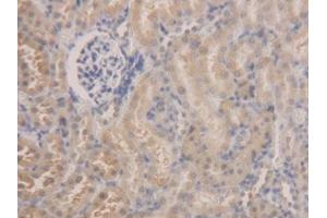 DAB staining on IHC-P; Samples: Rat Kidney Tissue (ALDH7A1 Antikörper  (AA 28-539))