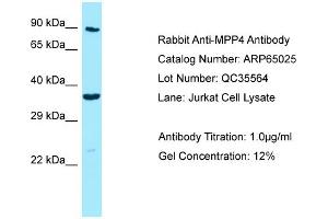 Western Blotting (WB) image for anti-Membrane Protein, Palmitoylated 4 (MAGUK P55 Subfamily Member 4) (MPP4) (C-Term) antibody (ABIN2790024) (MPP4 Antikörper  (C-Term))