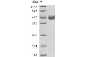 (Tris-Glycine gel) Discontinuous SDS-PAGE (reduced) with 5 % enrichment gel and 15 % separation gel.