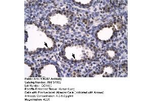 Human Lung (HMGB2 Antikörper  (C-Term))