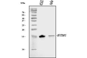 Western blot analysis of IFITM1 using anti-IFITM1 antibody (ABIN7598971).