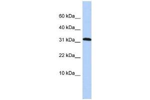DYSFIP1 antibody used at 1 ug/ml to detect target protein. (PPP1R27 Antikörper  (Middle Region))