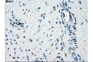 Immunohistochemical staining of paraffin-embedded Kidney tissue using anti-KDM4C mouse monoclonal antibody. (KDM4C Antikörper)