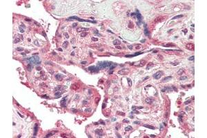 Human Placenta (formalin-fixed, paraffin-embedded) stained with PSENENat 5 µg/ml followed by biotinylated goat anti-rabbit IgG secondary antibody, alkaline phosphatase-streptavidin and chromogen. (PEN2 Antikörper  (N-Term))