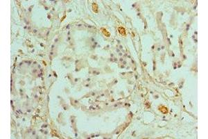 Immunohistochemistry of paraffin-embedded human prostate tissue using ABIN7146462 at dilution of 1:100 (Caldesmon Antikörper  (AA 1-240))