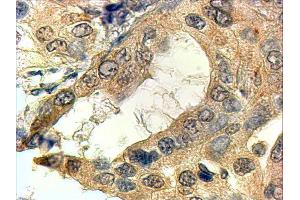 ABIN2560130 (4µg/ml) staining of paraffin embedded Human Prostate. (SRD5A1 Antikörper  (N-Term))