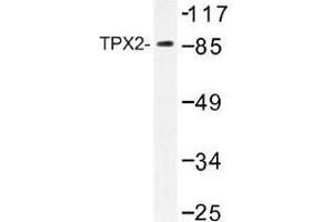Image no. 2 for anti-TPX2, Microtubule-Associated, Homolog (Xenopus Laevis) (TPX2) antibody (ABIN317807) (TPX2 Antikörper)