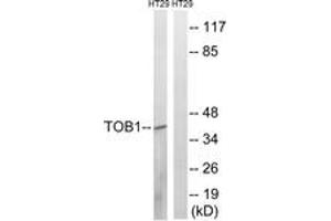 Western blot analysis of extracts from HT29 cells treated with serum 20% 15', using TOB1 (Phospho-Ser164) Antibody. (Protein Tob1 (TOB1) (AA 130-179), (pSer164) Antikörper)