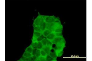 Immunofluorescence of purified MaxPab antibody to CHD9 on 293 cell. (CHD9 Antikörper  (AA 1-119))