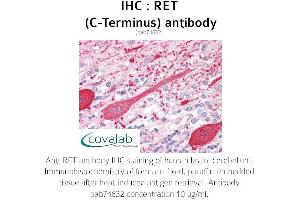 Image no. 1 for anti-Ret Proto-Oncogene (RET) (C-Term) antibody (ABIN5693697) (Ret Proto-Oncogene Antikörper  (C-Term))