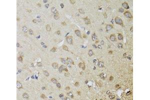 Immunohistochemistry of paraffin-embedded Rat brain using CHN1 Polyclonal Antibody at dilution of 1:100 (40x lens).