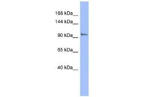 PI4KB antibody used at 1 ug/ml to detect target protein. (PI4KB Antikörper  (N-Term))
