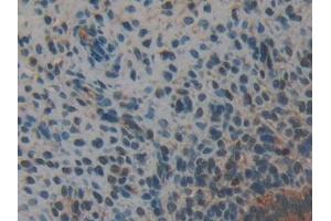 Detection of ANXA2 in Mouse Uterus Tissue using Polyclonal Antibody to Annexin A2 (ANXA2) (Annexin A2 Antikörper  (AA 1-339))