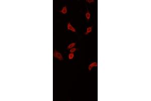 ABIN6268871 staining PC-12 cells by IF/ICC. (beta Synuclein Antikörper  (C-Term))