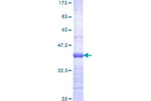 PIK3CB Protein (AA 147-256) (GST tag)