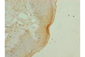 Immunohistochemistry of paraffin-embedded human skin tissue using ABIN7152281 at dilution of 1:100 (EXOSC1 Antikörper  (AA 9-195))