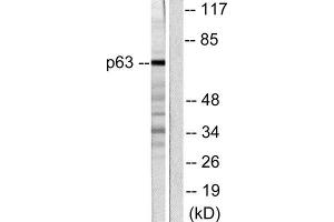 Western Blotting (WB) image for anti-T-Complex 1 (TCP1) (C-Term) antibody (ABIN1848722) (TCP1 alpha/CCTA Antikörper  (C-Term))