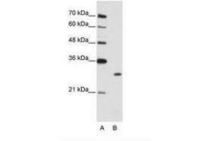 Image no. 1 for anti-Muscleblind-like Protein 1 (MBNL1) (C-Term) antibody (ABIN202283) (MBNL1 Antikörper  (C-Term))