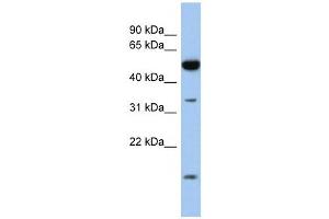 RDH12 antibody used at 1 ug/ml to detect target protein. (RDH12 Antikörper)