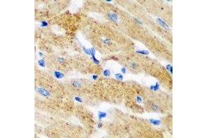 Immunohistochemical analysis of HNMT staining in mouse heart formalin fixed paraffin embedded tissue section.