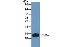 Detection of Recombinant FABP1, Human using Monoclonal Antibody to Fatty Acid Binding Protein 1 (FABP1) (FABP1 Antikörper  (AA 2-127))