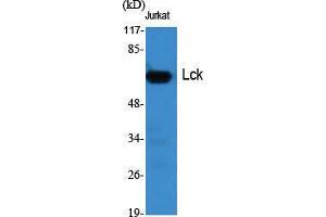Western Blot (WB) analysis of specific cells using Lck Polyclonal Antibody. (LCK Antikörper  (Ser736))
