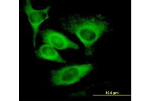 Image no. 1 for anti-Eukaryotic Translation Initiation Factor 5 (EIF5) (AA 1-432) antibody (ABIN598657) (EIF5 Antikörper  (AA 1-432))