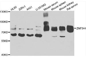 Western blot analysis of extracts of various cell lines, using ZNF544 antibody. (ZNF544 Antikörper)