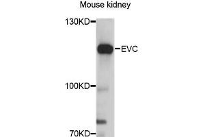 Western blot analysis of extracts of mouse kidney, using EVC antibody (ABIN6290358) at 1:3000 dilution.