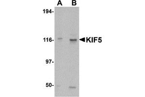 Western Blotting (WB) image for anti-Kinesin Family Member 5A (KIF5A) (C-Term) antibody (ABIN1030467) (KIF5A Antikörper  (C-Term))