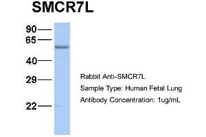 Host:  Rabbit  Target Name:  SMCR7L  Sample Type:  Human Fetal Lung  Antibody Dilution:  1. (SMCR7L Antikörper  (N-Term))